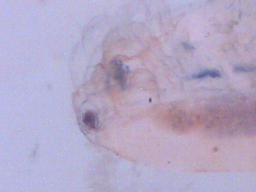 microinvertebrato? Copepode - con uova?